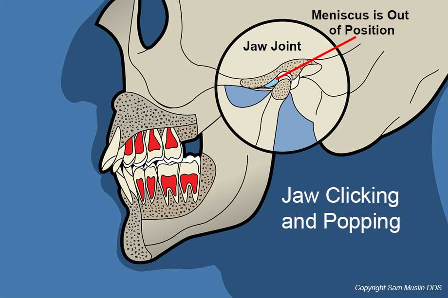 MJ jaw clicking and popping featured image