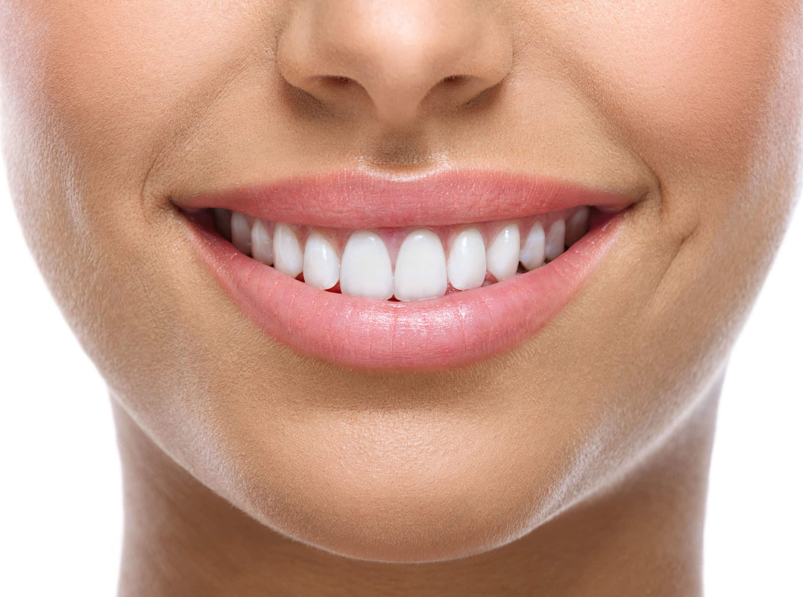 how much are veneers and cost of a full set of veneers