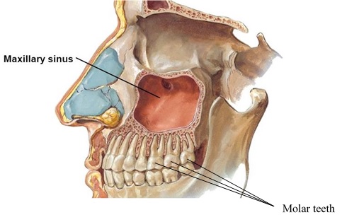 ilustración del dolor de muelas e infección de los senos nasales