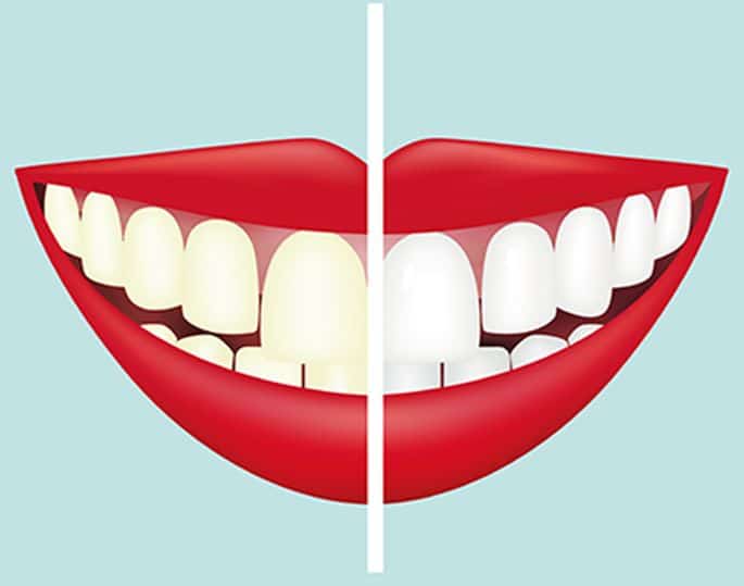 Meilleures dents : comment se blanchir les dents à la maison