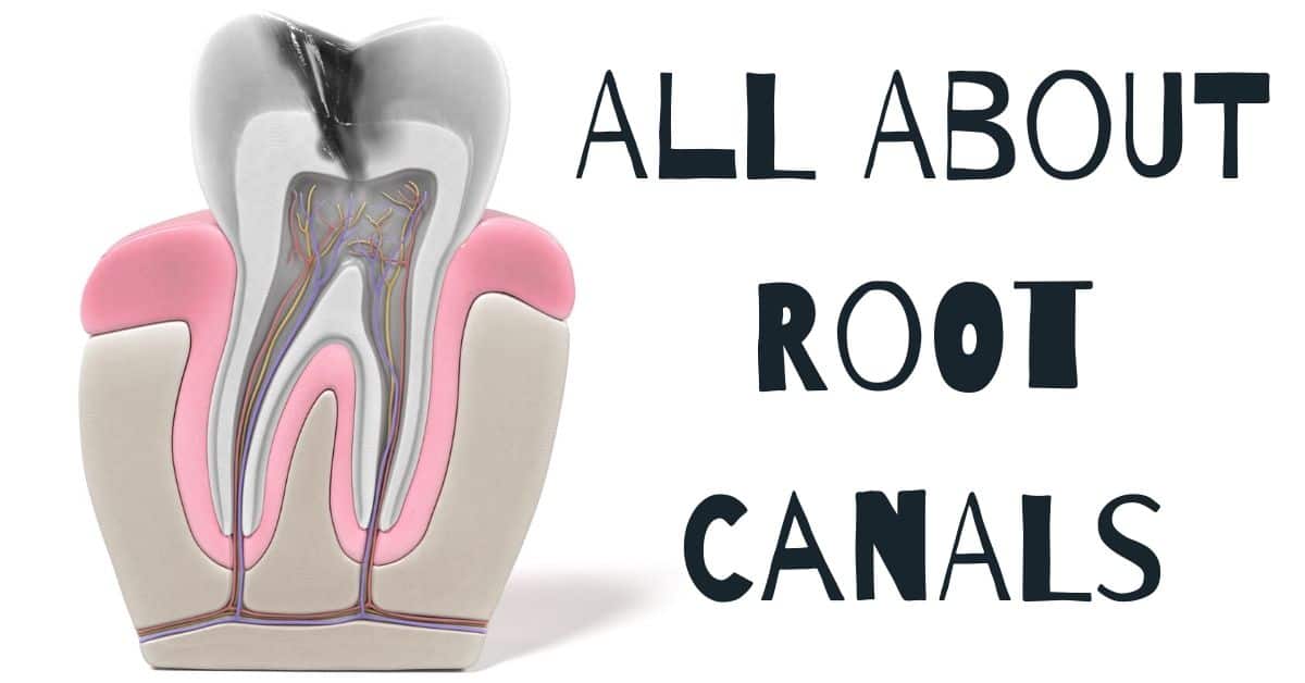 do root canals hurts & root canal and crown featured image